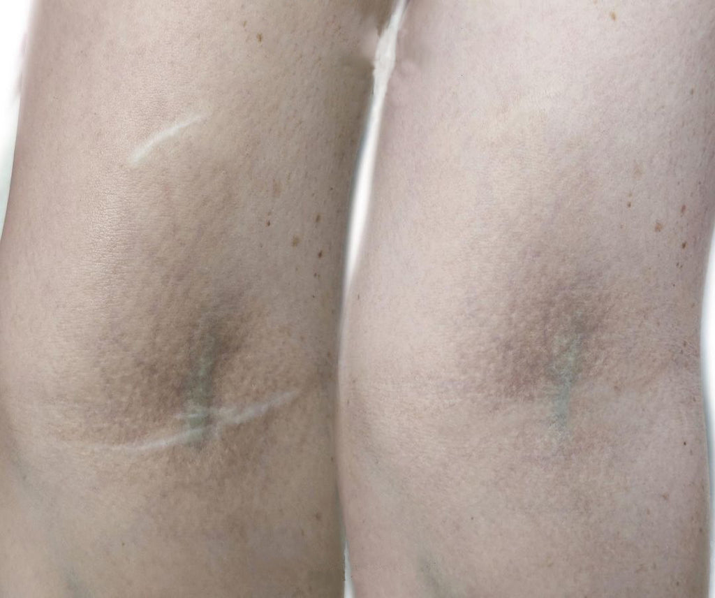 Tattooing and Medical Applications: Tattoos for Identification, Medical Conditions, and Prosthetics